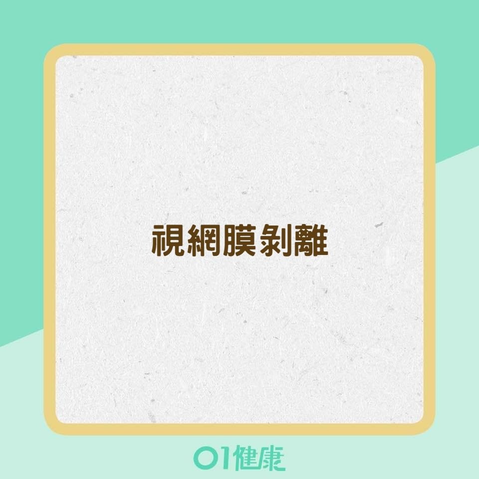 高度近視可能造成的疾病(01製圖) 高度近視可能造成的疾病(01製圖)