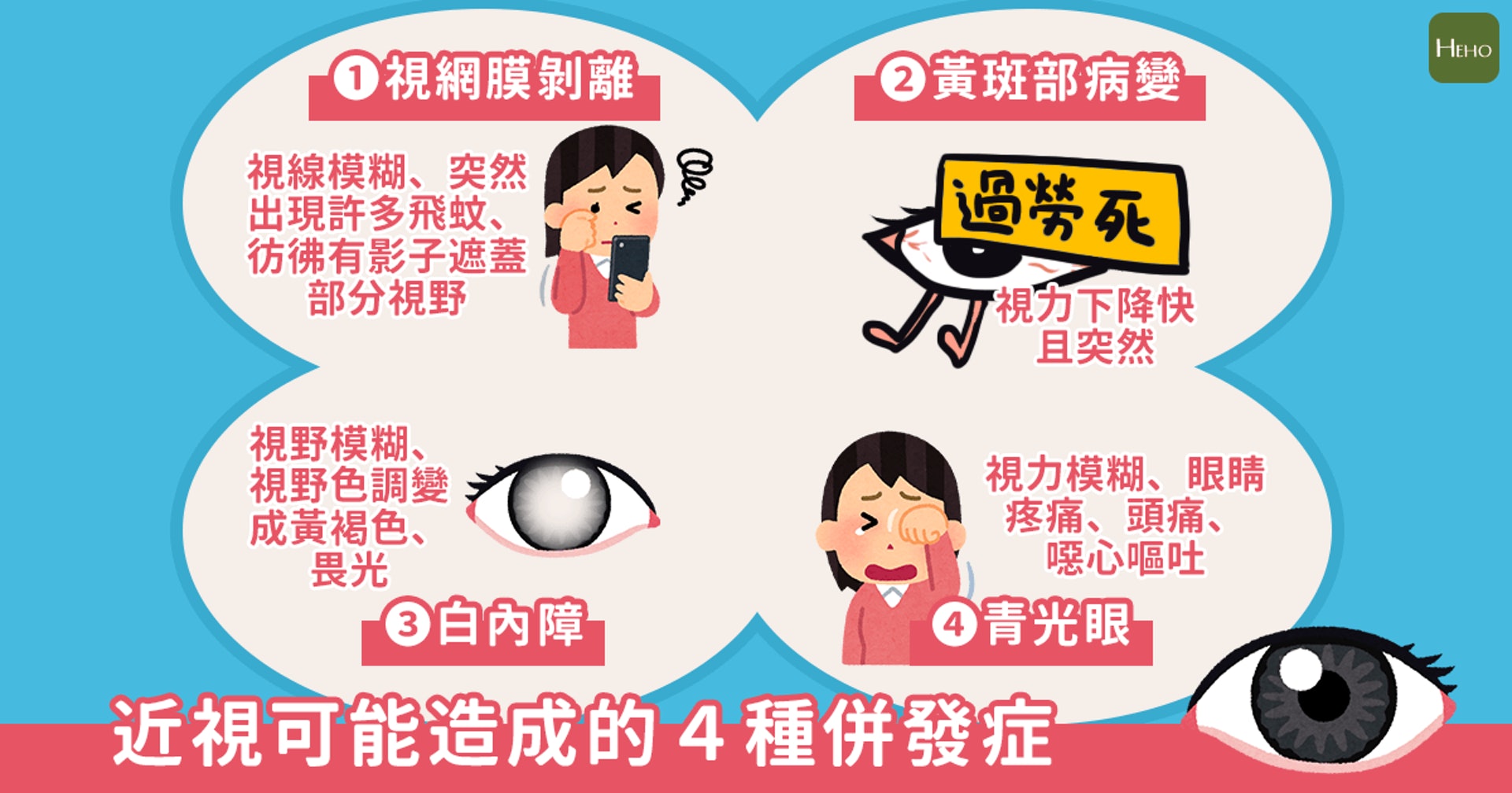 近視可能造成的4種併發症 (Heho健康授權使用) 近視可能造成的4種併發症 (Heho健康授權使用)