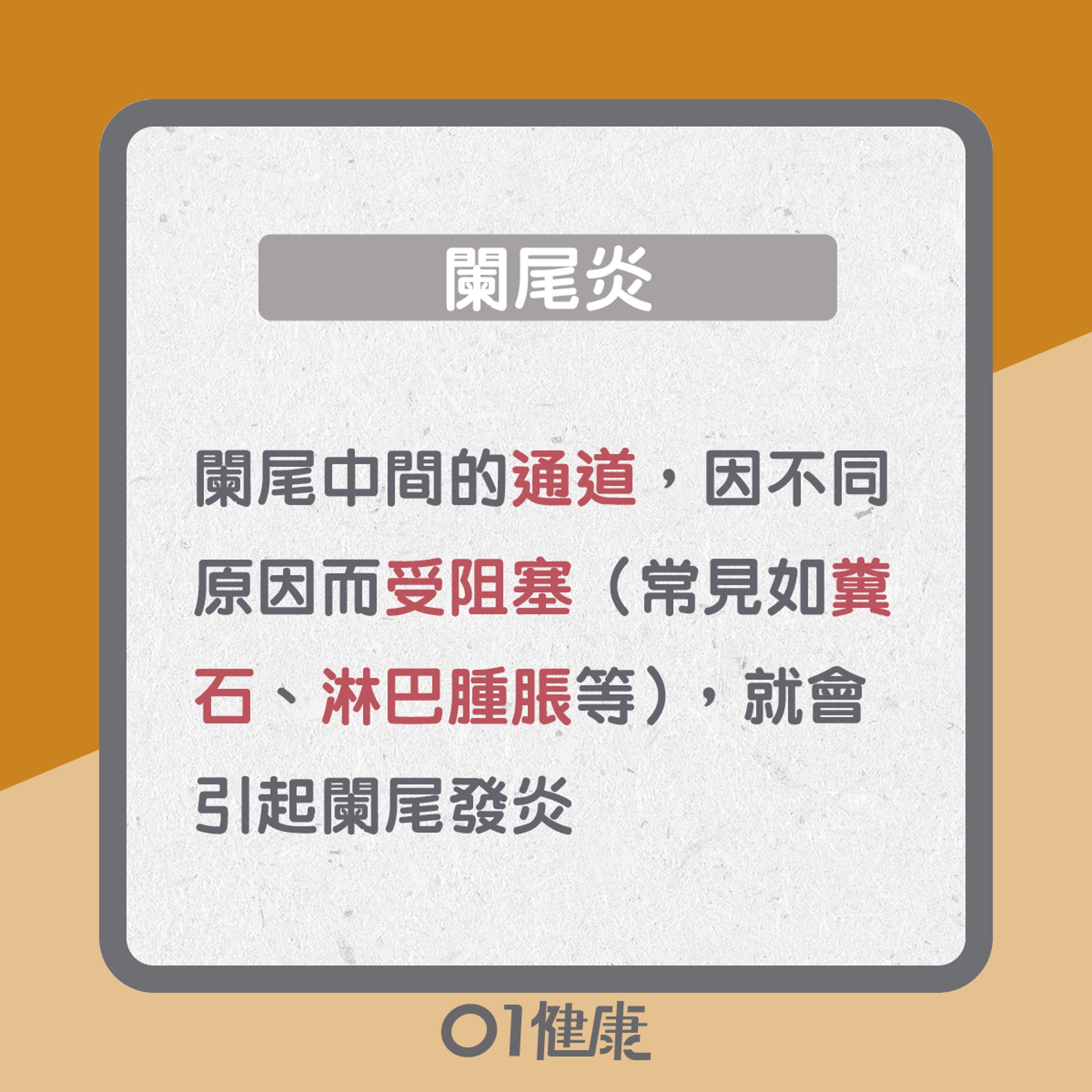 闌尾炎知多啲(01製圖) 闌尾炎知多啲(01製圖)