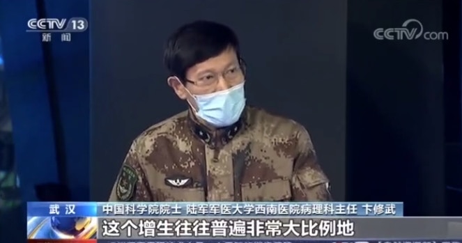 武漢肺炎 新冠與沙士患者肺部有何區別 專家分析有3大不同