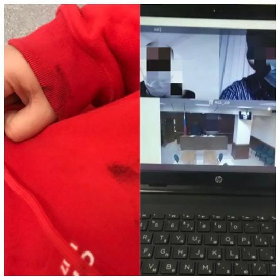 孫瑩被強迫按手印時，衣服沾染了油墨；及後遭遇網上視像庭審。（北京青年報）