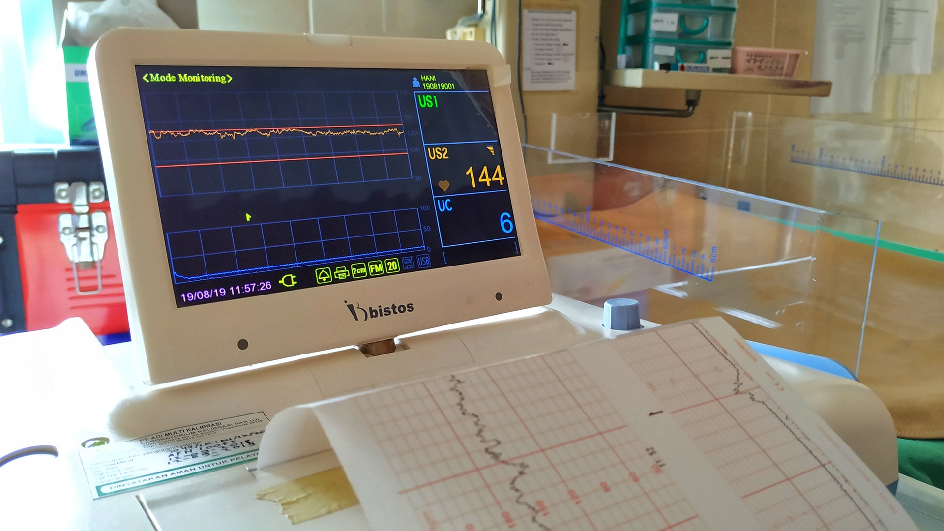 R先生雖然有運動習慣，但體檢時心電圖卻出現異常，顯示心臟有不尋常問題。（shutter stock）