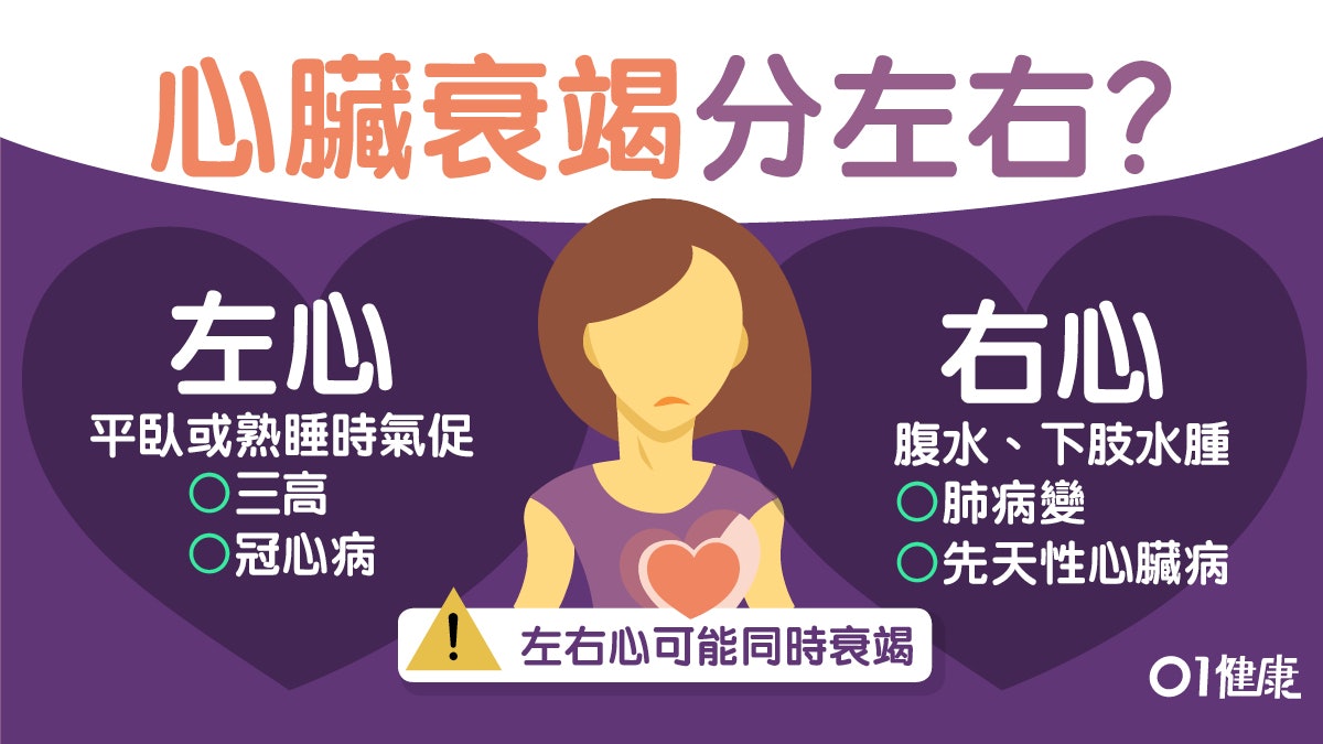 【心臟病】氣喘肚脹難集中可能心臟衰竭?左右症狀不同程度分4級 【心臟病】氣喘肚脹難集中可能心臟衰竭?左右症狀不同程度分4級