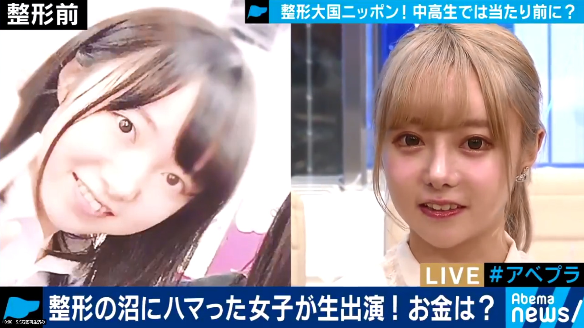 日本整容年輕化 因告白被拒少女17歲起整容花600萬円變娃娃臉 香港01 開罐