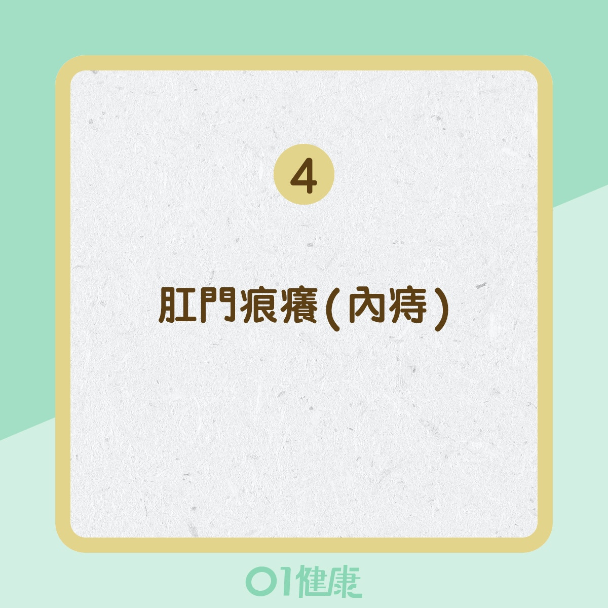 痔瘡的症狀 (01製圖) 痔瘡的症狀 (01製圖)