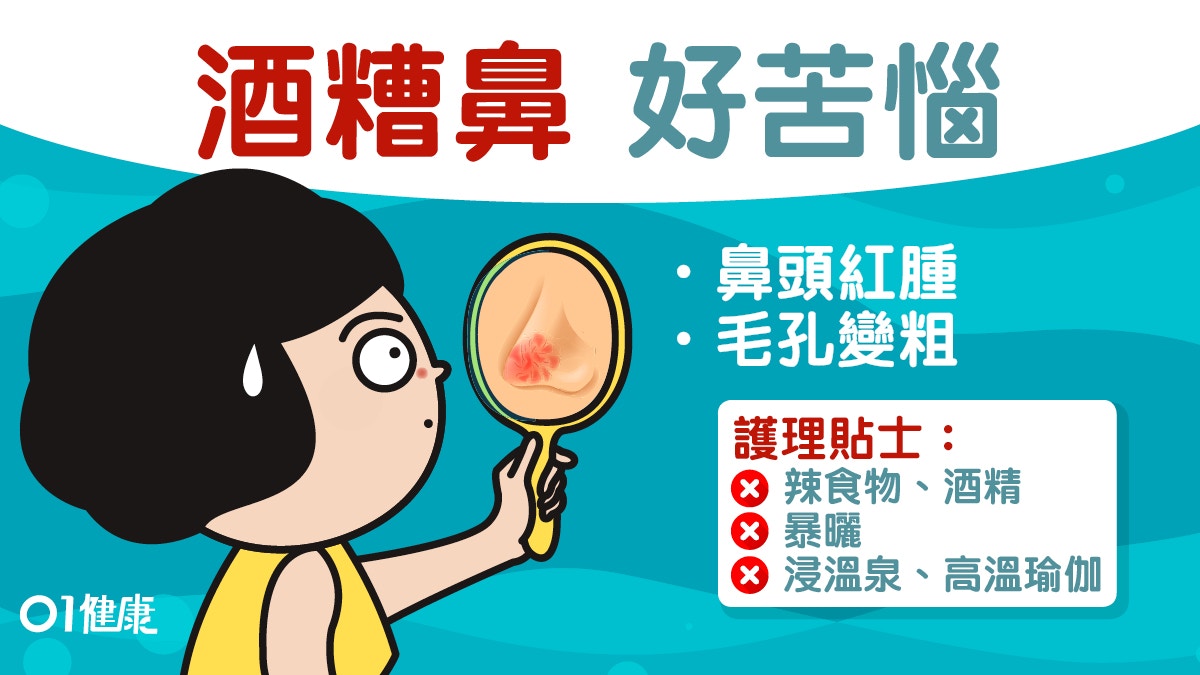 【玫瑰痤瘡】症狀似暗瘡濕疹　認清三者分別免用錯藥膏痤瘡更嚴重