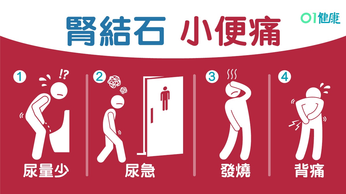 【腎結石】小便灼熱常尿急8大症狀似尿道感染 嚴重可致腎衰竭! 【腎結石】小便灼熱常尿急8大症狀似尿道感染 嚴重可致腎衰竭!