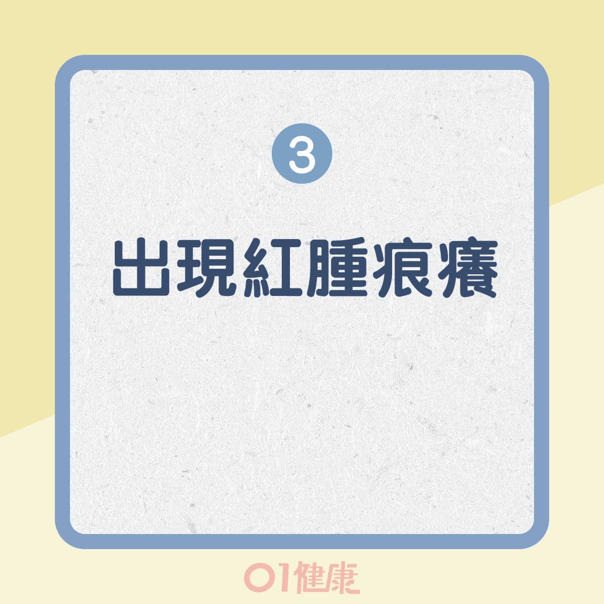 眼睛過敏的護理方法(01製圖) 眼睛過敏的護理方法(01製圖)