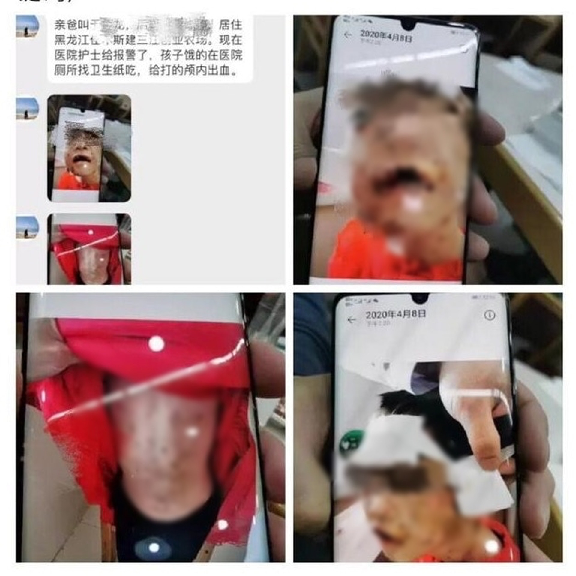 網民在微博爆料稱,黑龍江出現虐童案件。(網上圖片) 網民在微博爆料稱,黑龍江出現虐童案件。(網上圖片)