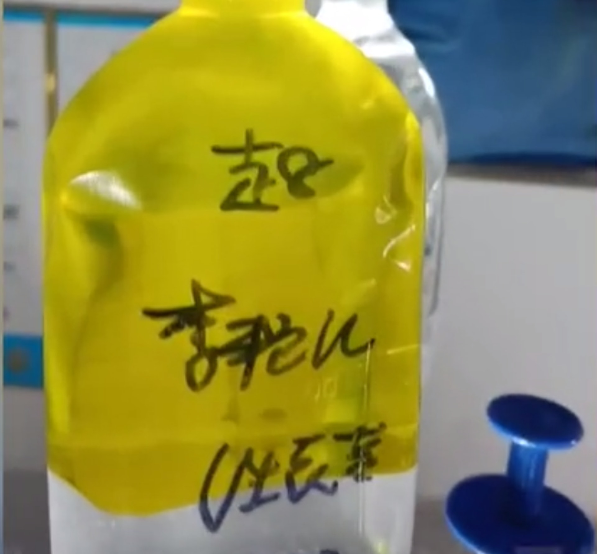 患者陳艷花的輸液藥瓶上的名字非本人,而是「李艷紅」。(網上圖片) 患者陳艷花的輸液藥瓶上的名字非本人,而是「李艷紅」。(網上圖片)