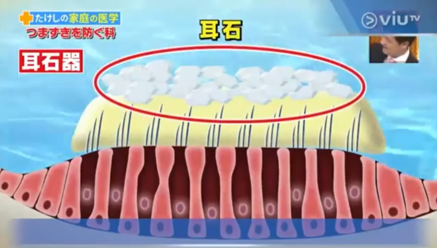 耳石器是掌管身體平衡力。(viu TV《恐怖醫學》影片截圖) 耳石器是掌管身體平衡力。(viu TV《恐怖醫學》影片截圖)