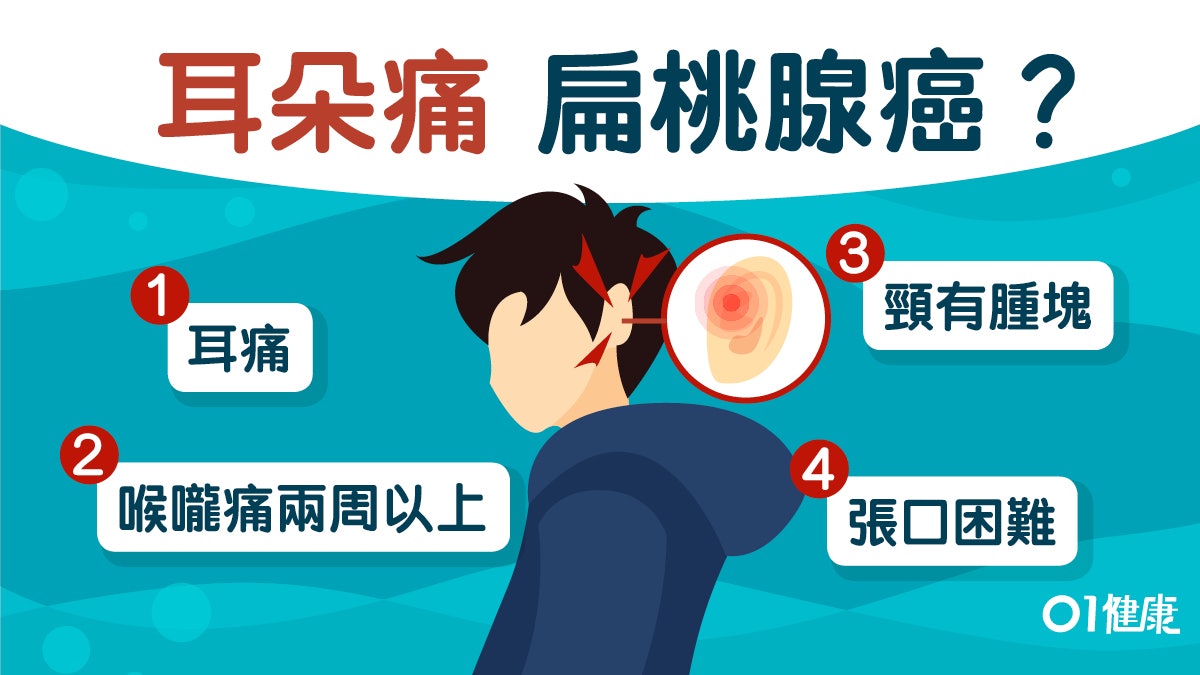 【癌症】耳仔痛可能是扁桃腺癌前兆?同時出現這5大症狀快就醫 【癌症】耳仔痛可能是扁桃腺癌前兆?同時出現這5大症狀快就醫