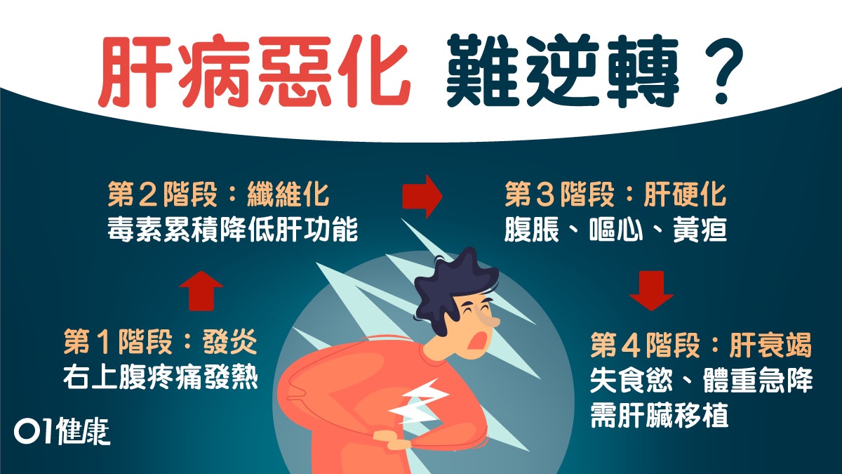 【肝功能衰竭】肝病必經4階段纖維化可自癒?腳腫肚脹肝硬化徵兆 【肝功能衰竭】肝病必經4階段纖維化可自癒?腳腫肚脹肝硬化徵兆