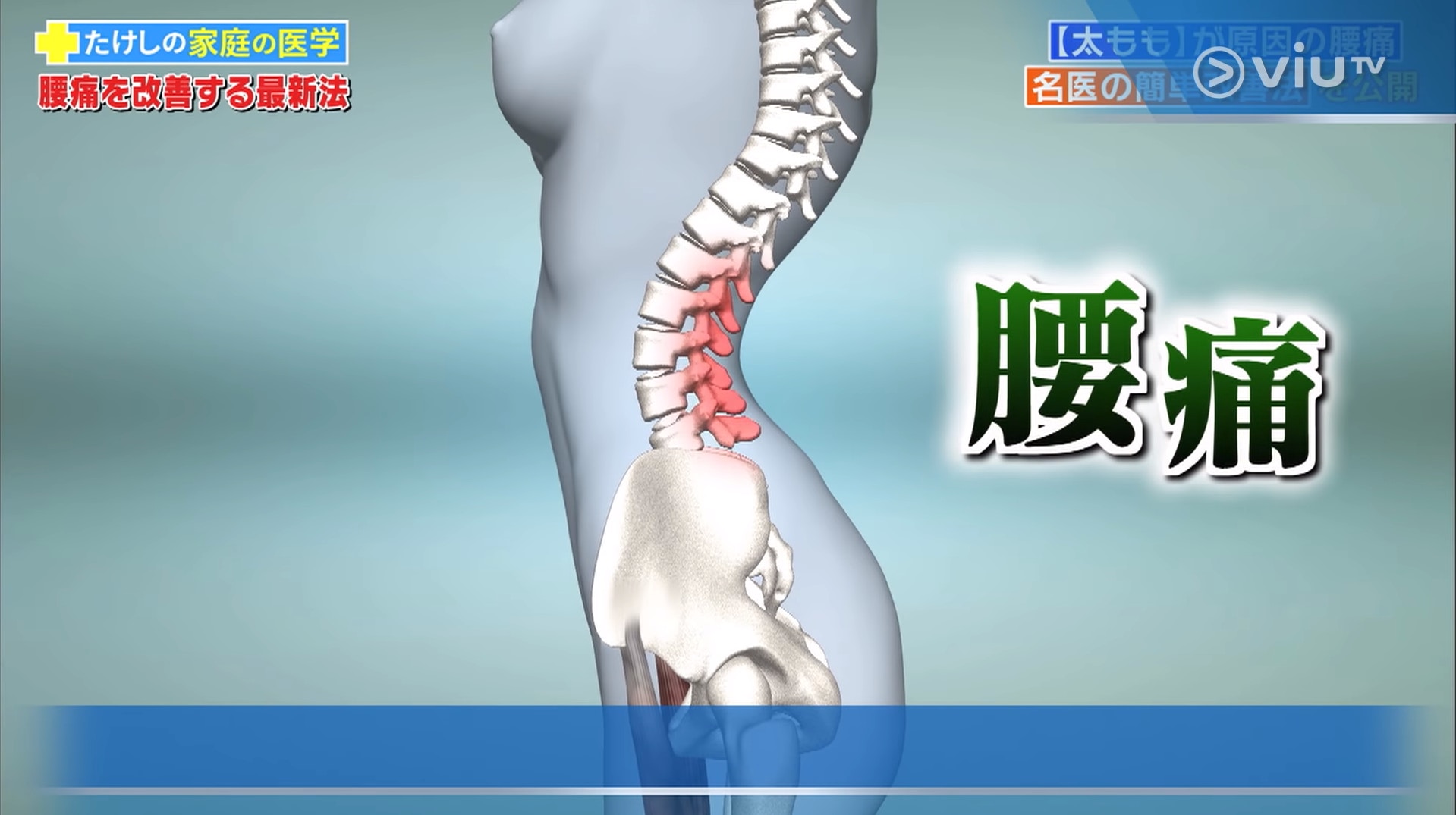 當腰部負擔增加,就會容易造成腰痛。(viu TV《恐怖醫學》影片截圖) 當腰部負擔增加,就會容易造成腰痛。(viu TV《恐怖醫學》影片截圖)