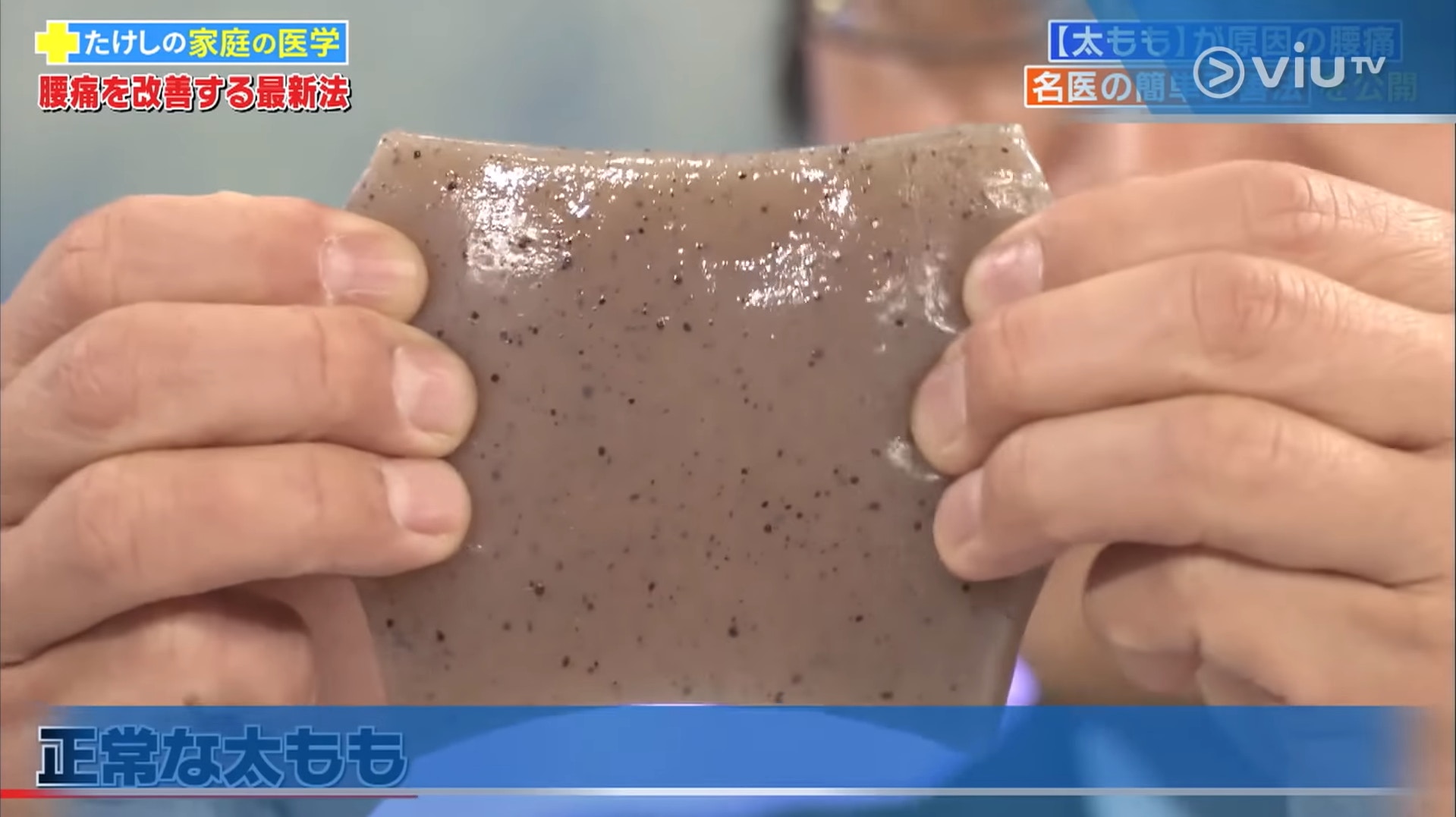 正常的大腿肌肉應像新觧的蒟蒻般有彈性、可伸展。(viu TV《恐怖醫學》影片截圖) 正常的大腿肌肉應像新觧的蒟蒻般有彈性、可伸展。(viu TV《恐怖醫學》影片截圖)