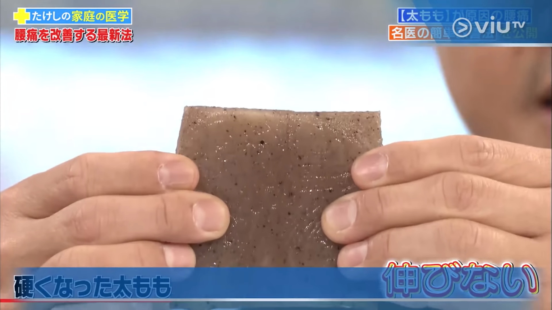 退化的大腿肌肉則像乾掉的蒟蒻般硬邦邦、無法伸展。(viu TV《恐怖醫學》影片截圖) 退化的大腿肌肉則像乾掉的蒟蒻般硬邦邦、無法伸展。(viu TV《恐怖醫學》影片截圖)