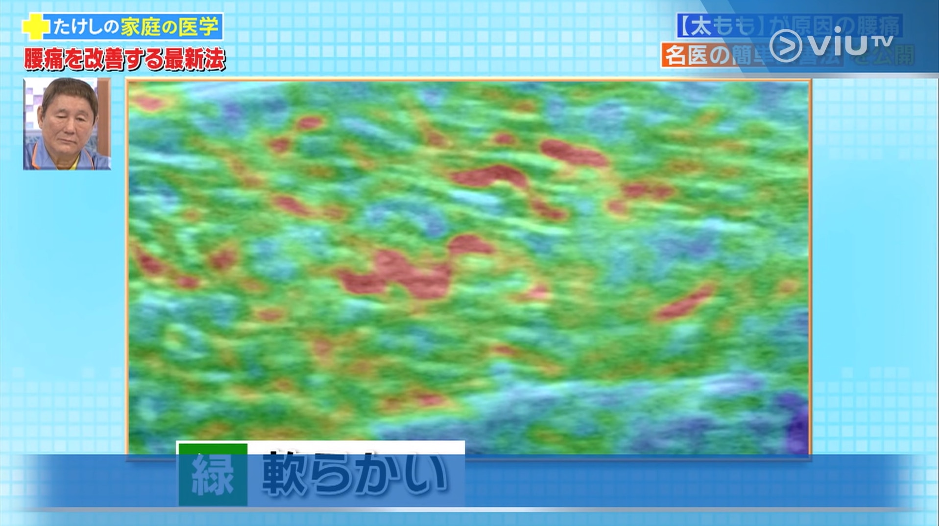 綠色表示肌肉柔軟度足夠(viu TV《恐怖醫學》影片截圖) 綠色表示肌肉柔軟度足夠(viu TV《恐怖醫學》影片截圖)