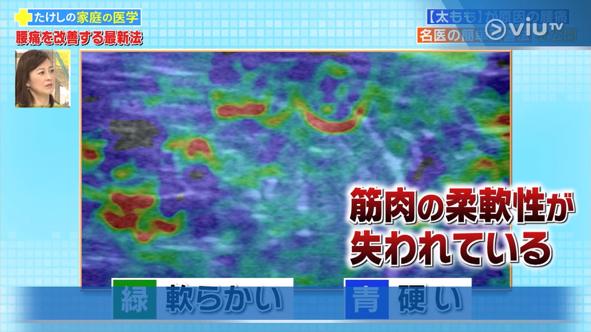 藍色顯示肌肉較硬(viu TV《恐怖醫學》影片截圖) 藍色顯示肌肉較硬(viu TV《恐怖醫學》影片截圖)