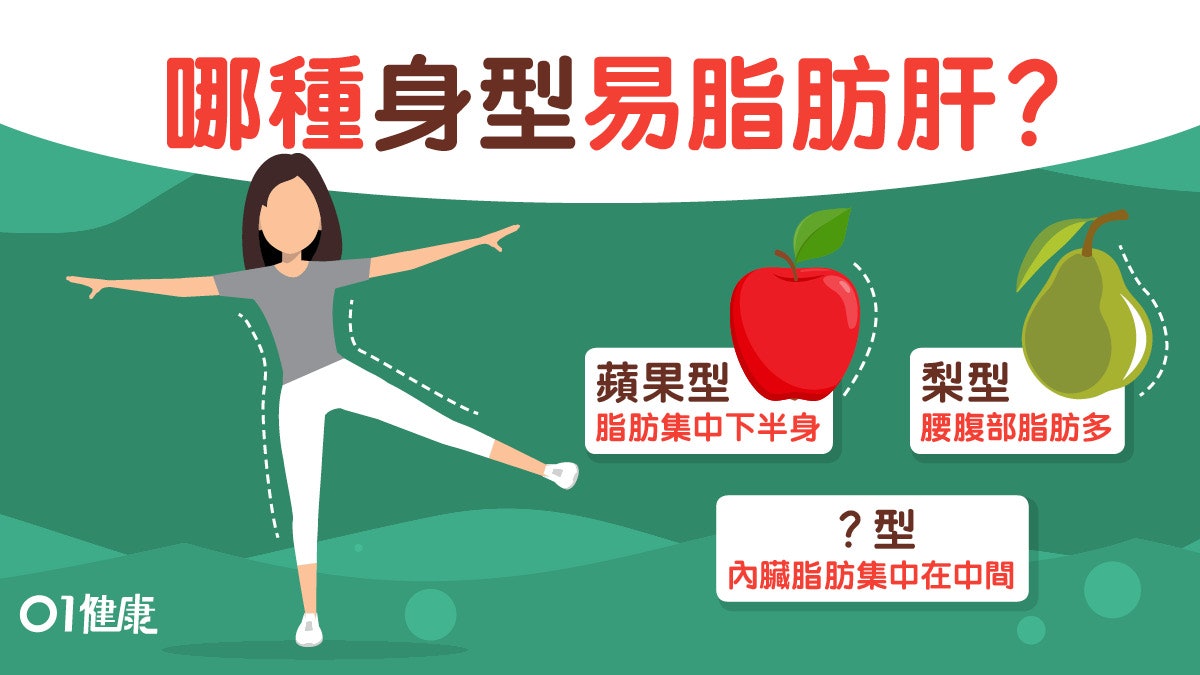 脂肪肝 減肥過度易致脂肪肝2大原因有些人天生易累積脂肪 香港01 健康