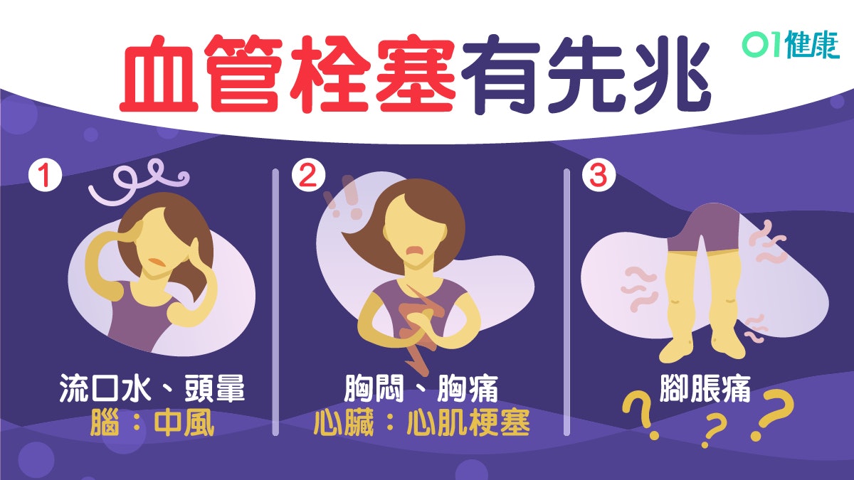 【中風】心臟病或因血栓堵塞3個部位所致 留意腳腫氣喘6大症狀! 【中風】心臟病或因血栓堵塞3個部位所致 留意腳腫氣喘6大症狀!