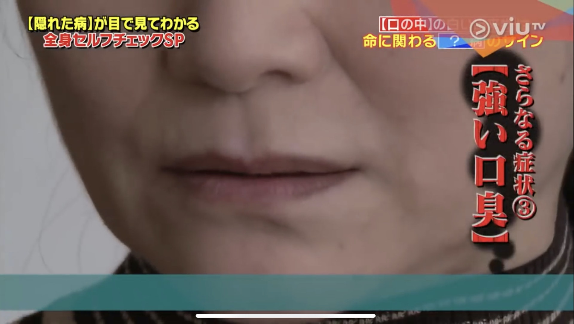 及後口腔甚至會發出令人難以忍受,如腐爛垃圾般的臭味!(Viu TV《恐怖醫學》影片截圖) 及後口腔甚至會發出令人難以忍受,如腐爛垃圾般的臭味!(Viu TV《恐怖醫學》影片截圖)