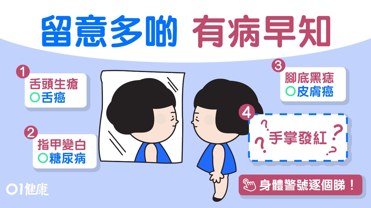 自我體檢 指甲白糖尿病舌頭生瘡或患癌 9個疾病警號目測都睇到 香港01 健康