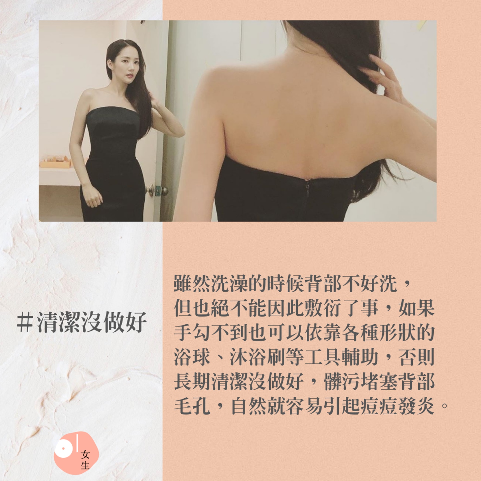 【6個日常壞習慣成背部痘痘爆發的原因】(IG@rachel_mypark/01製圖) 【6個日常壞習慣成背部痘痘爆發的原因】(IG@rachel_mypark/01製圖)