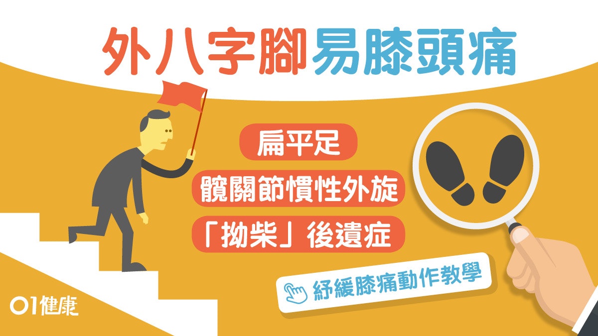 【扁平足】膝關節痛或因外八字腳上樓梯 2個動作紓緩及鍛練肌肉 【扁平足】膝關節痛或因外八字腳上樓梯 2個動作紓緩及鍛練肌肉