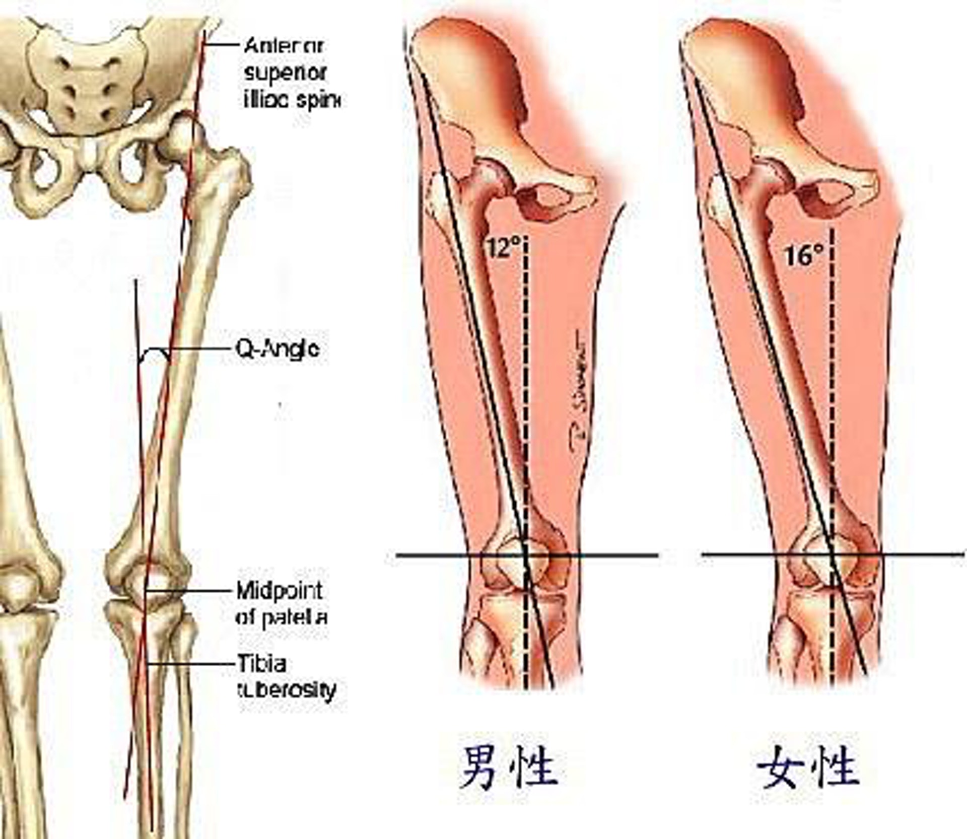 女性股四頭肌生理夾角（網上圖片）