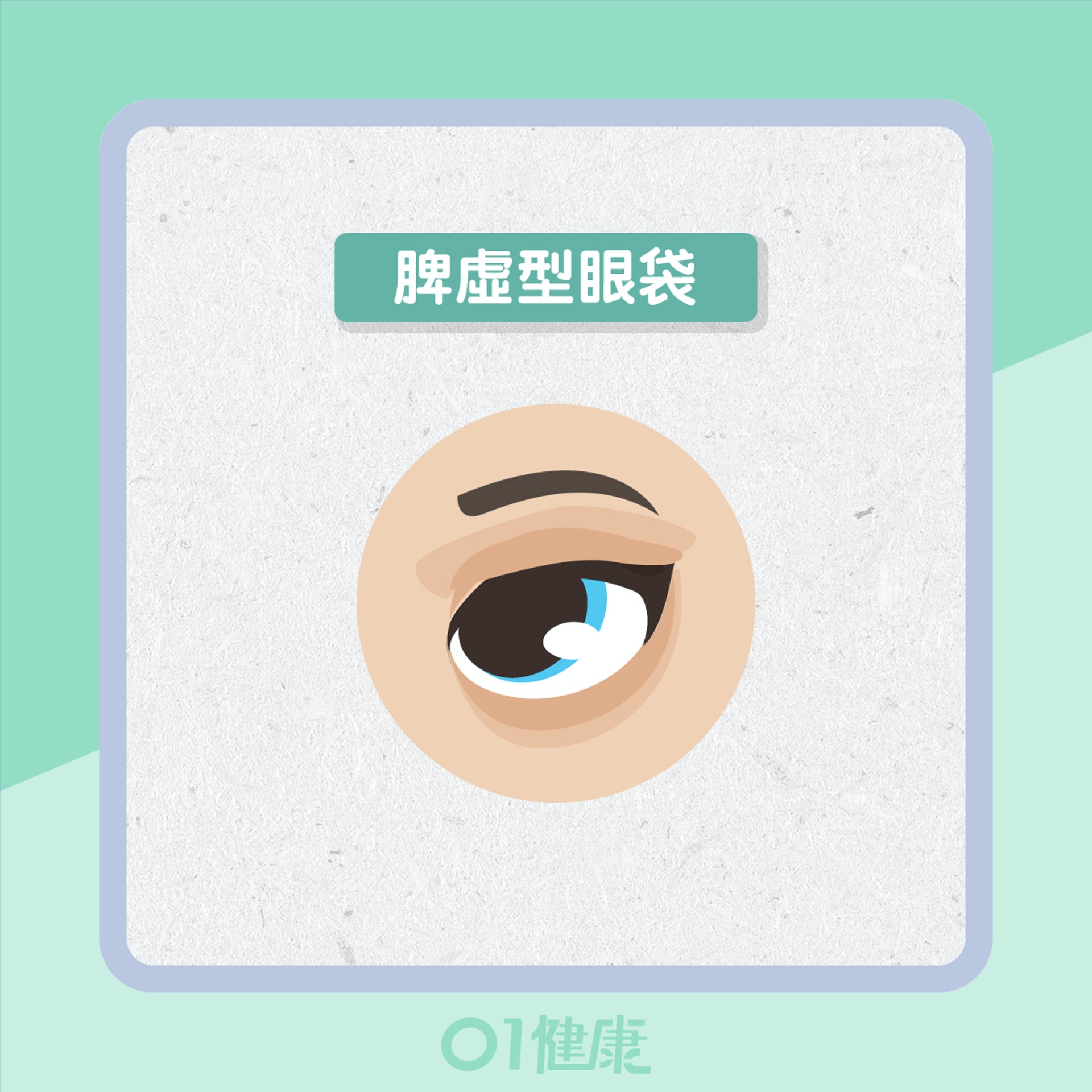 3種眼袋反映健康(01製圖) 3種眼袋反映健康(01製圖)