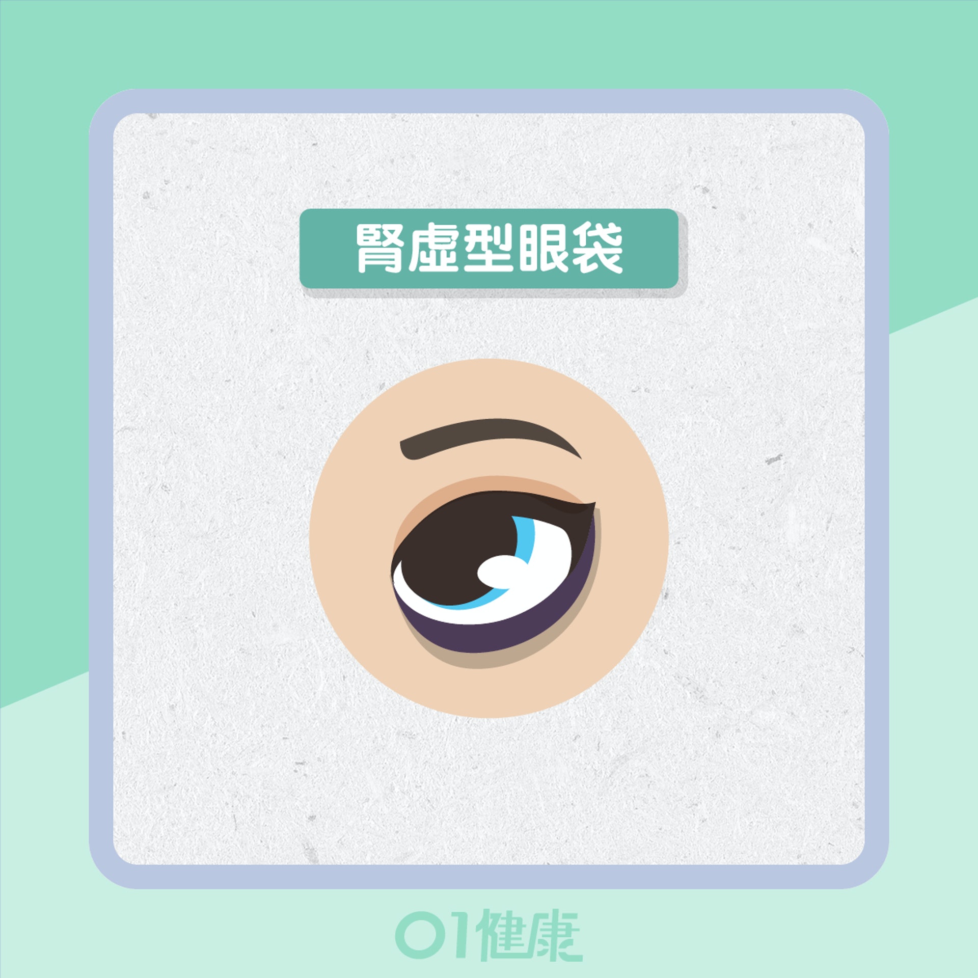 3種眼袋反映健康(01製圖) 3種眼袋反映健康(01製圖)