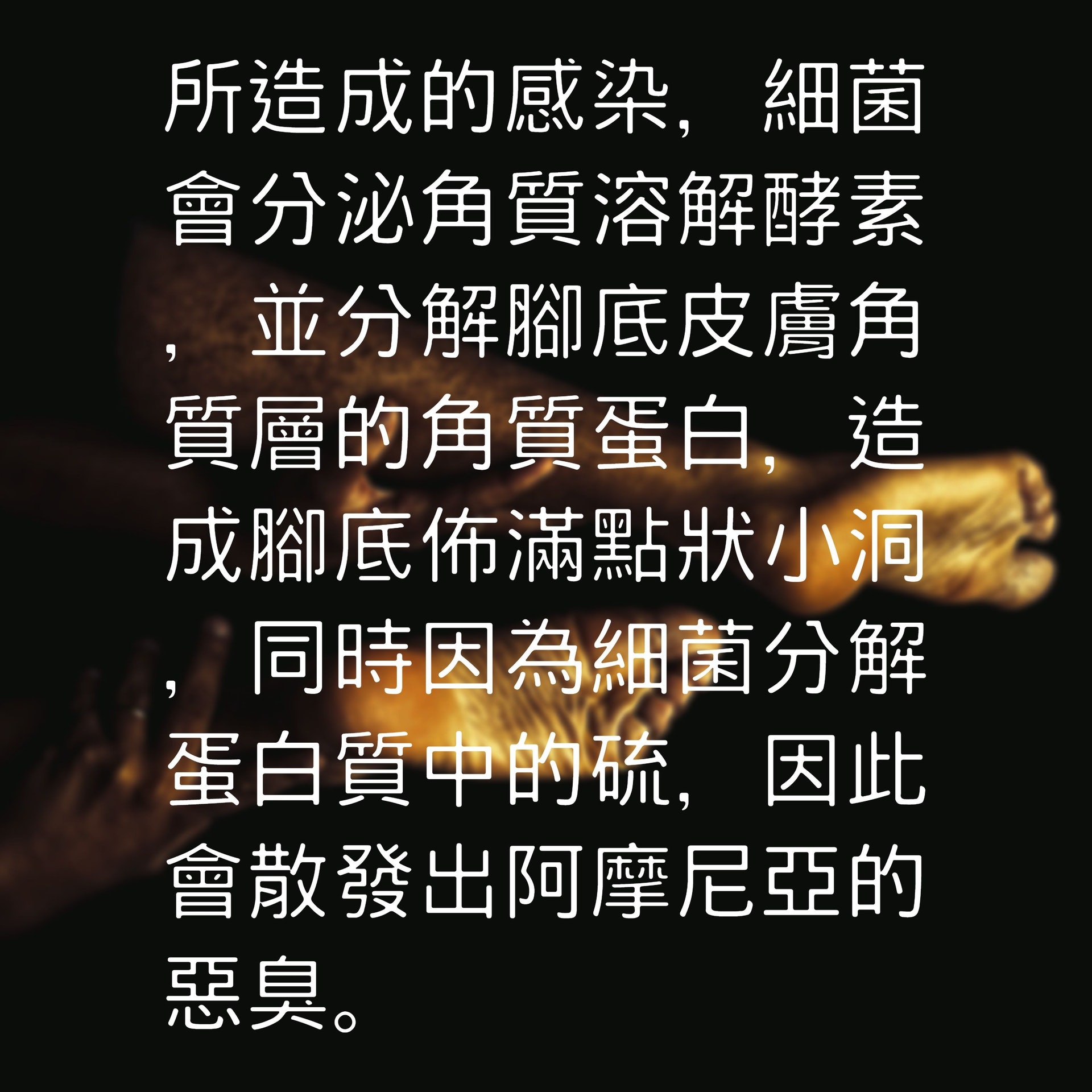 隻腳臭崩崩竟非香港腳?(01製圖/Unsplash@cristian_newman) 隻腳臭崩崩竟非香港腳?(01製圖/Unsplash@cristian_newman)