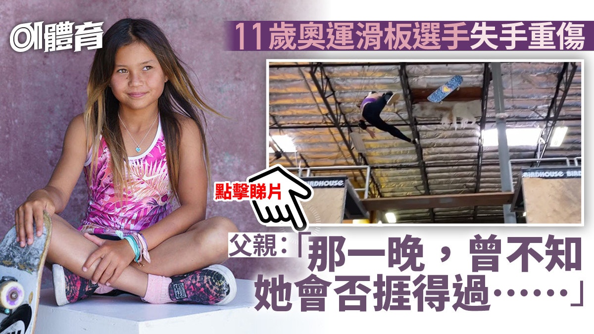 【東京奧運】11歲職業滑板女將15呎高墮下重傷 頭骨骨裂心肺受創 【東京奧運】11歲職業滑板女將15呎高墮下重傷 頭骨骨裂心肺受創
