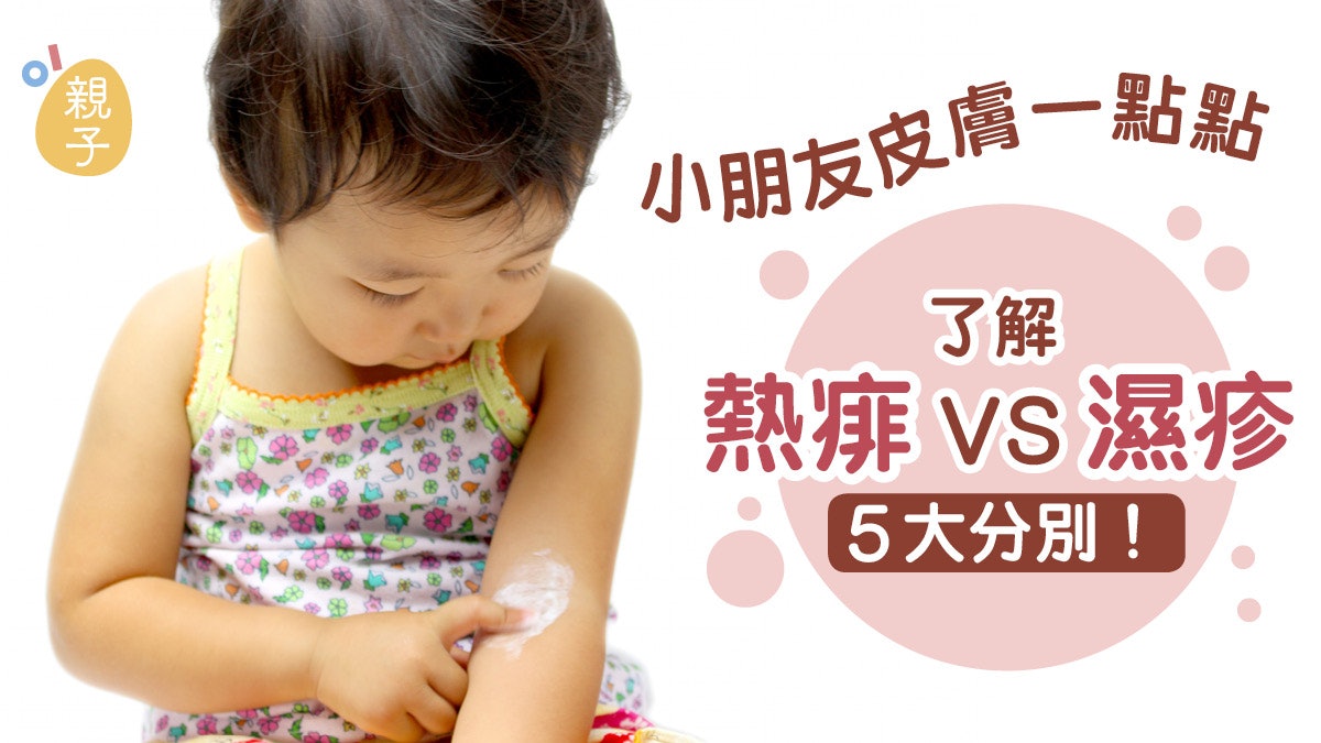 【皮膚問題】小朋友皮膚出紅點勿驚慌 認清濕疹和熱痱5大分別 【皮膚問題】小朋友皮膚出紅點勿驚慌 認清濕疹和熱痱5大分別