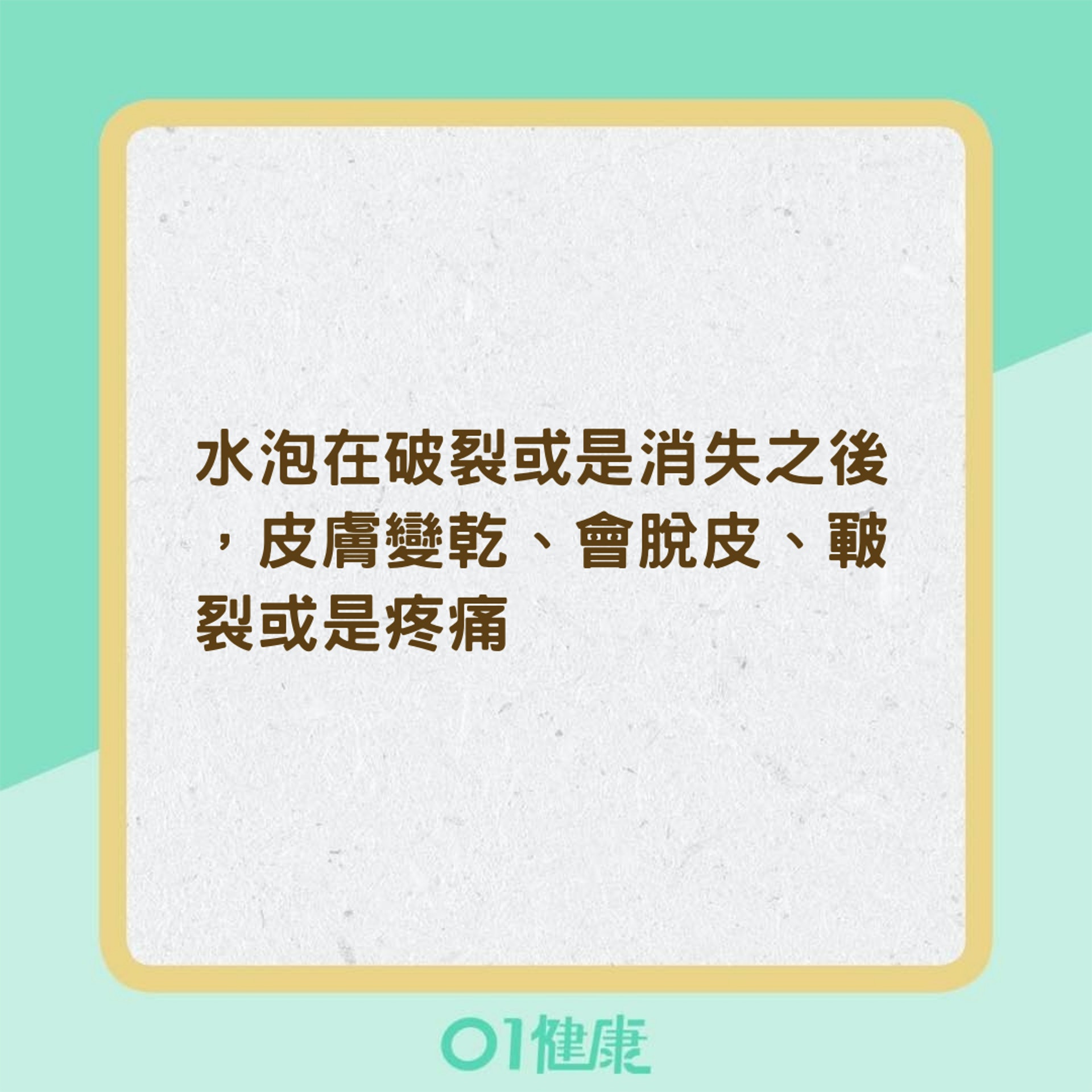 汗皰疹的症狀(01製圖) 汗皰疹的症狀(01製圖)