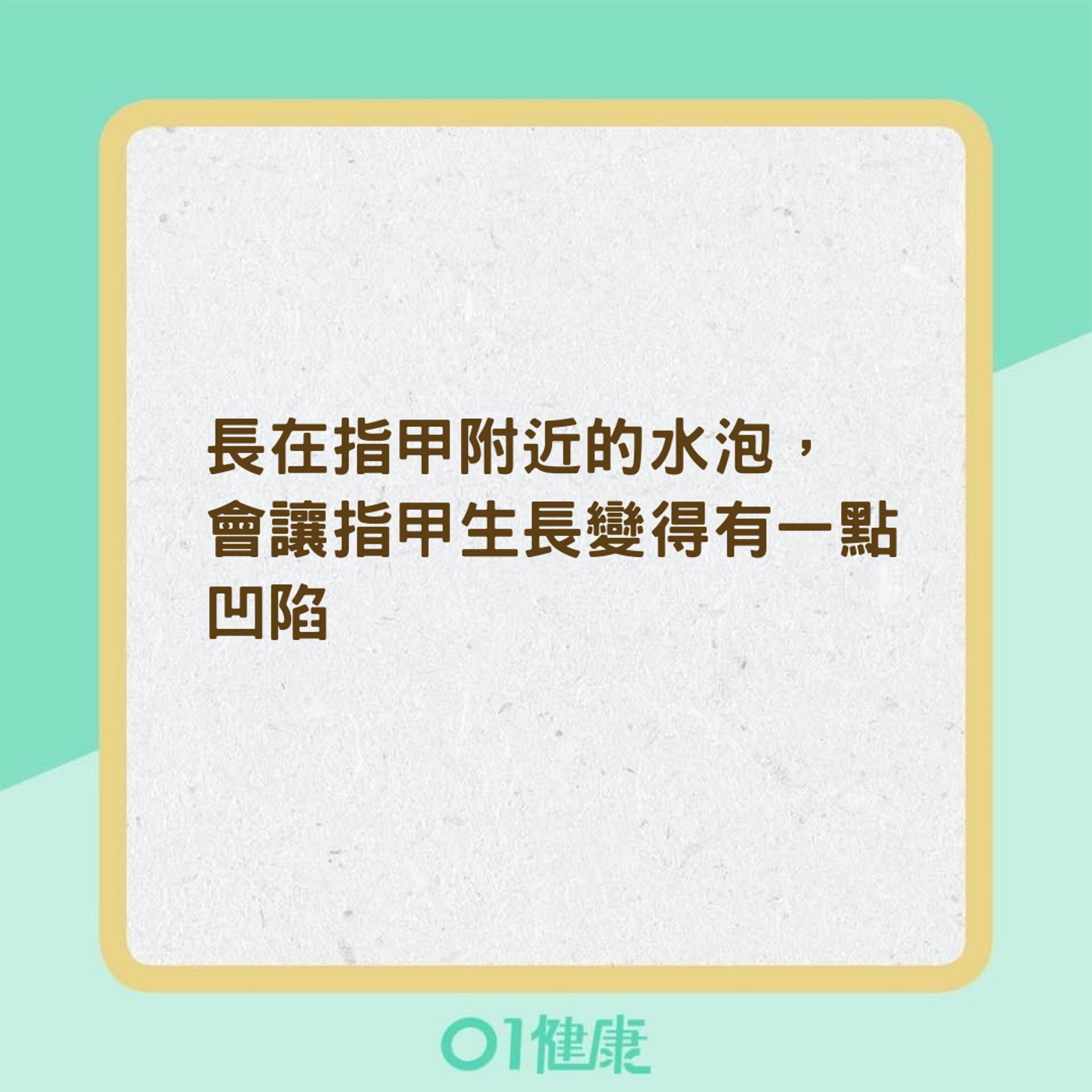 汗皰疹的症狀(01製圖) 汗皰疹的症狀(01製圖)