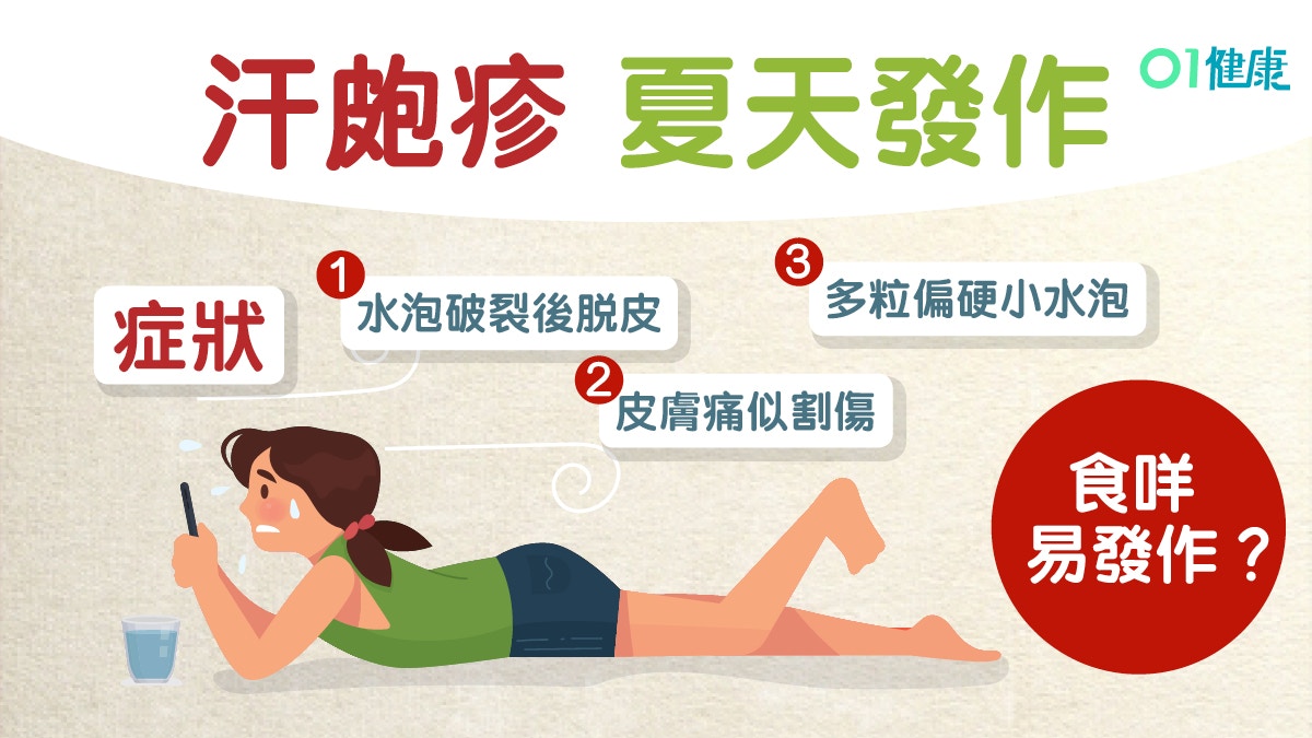 香港腳 汗皰疹小水泡夏天常發作3大致敏源戒咖啡朱古力綠茶 香港腳 汗皰疹小水泡夏天常發作3大致敏源戒咖啡朱古力綠茶