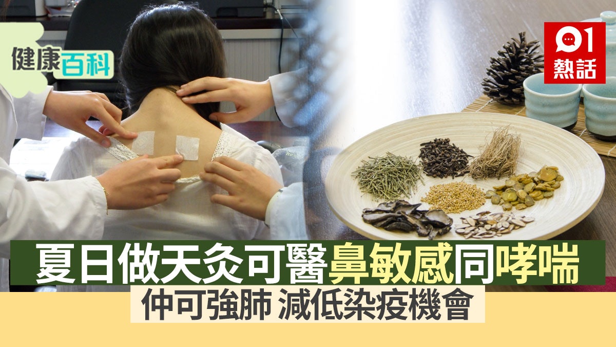 健康百科|夏日天灸養生兼增抵抗力 三伏天最適合因全年陽氣最盛 健康百科|夏日天灸養生兼增抵抗力 三伏天最適合因全年陽氣最盛