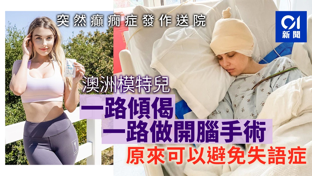 澳洲知名模特兒逛街突癲癇發作 要邊做開腦手術邊醒着說話防失語 澳洲知名模特兒逛街突癲癇發作 要邊做開腦手術邊醒着說話防失語