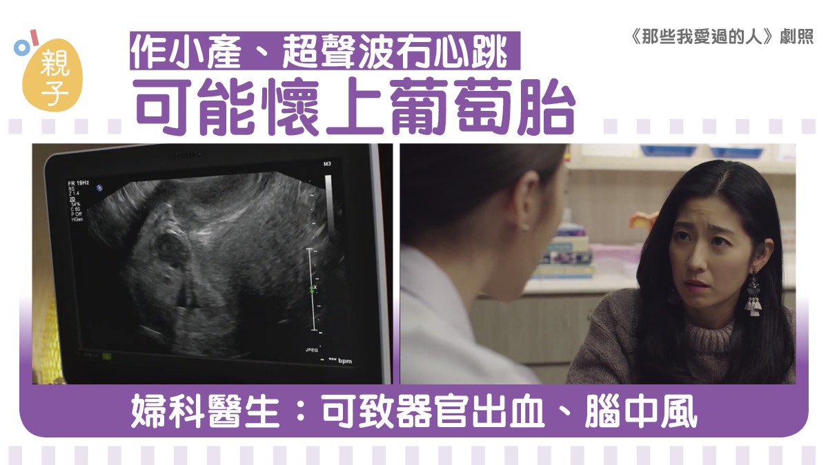 葡萄胎 | 葡萄胎症狀及後遺症 醫生:可致器官出血