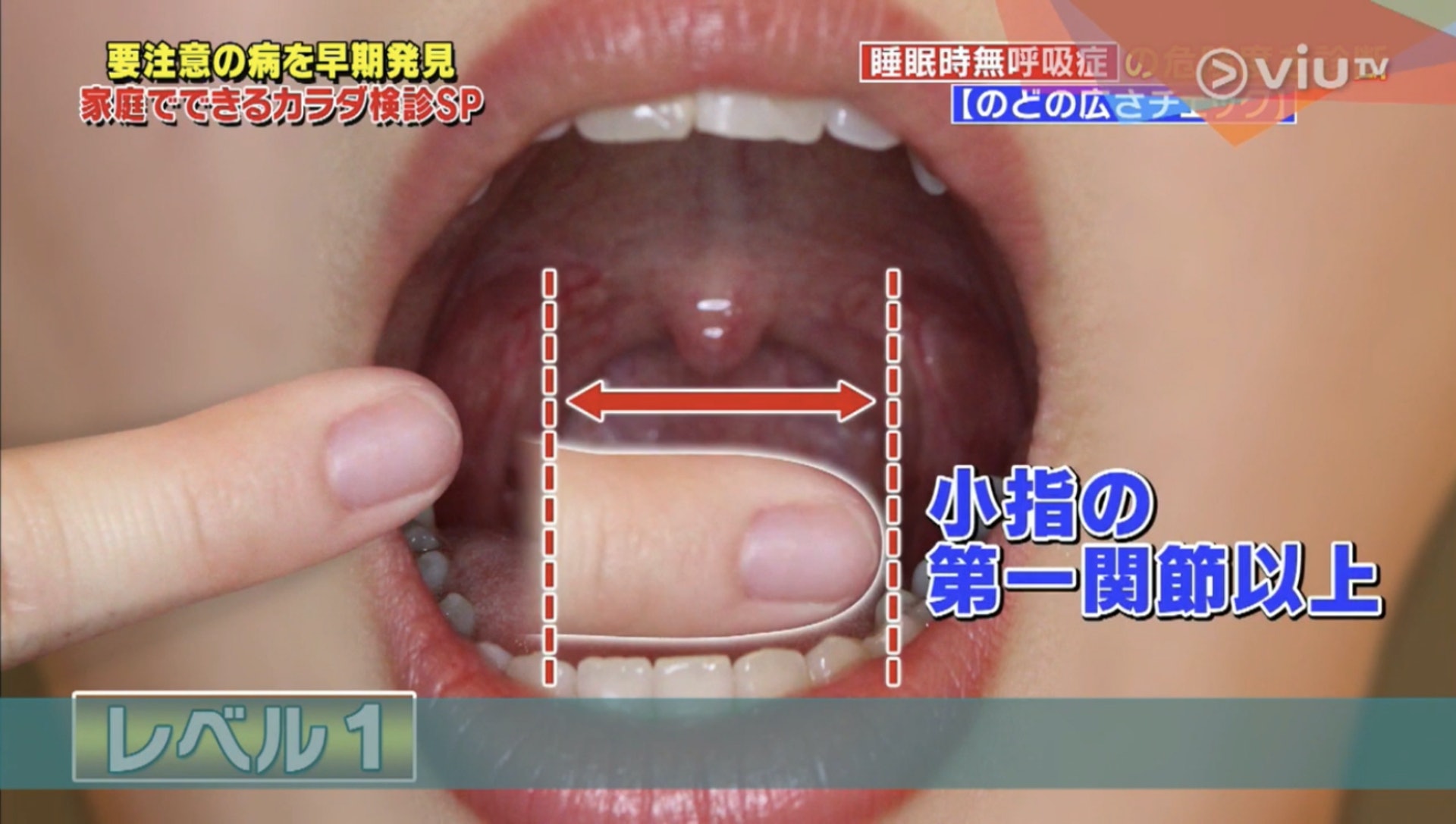 同時喉嚨開口左右的闊度長於尾指第一節（Viu TV《恐怖醫學》影片截圖）