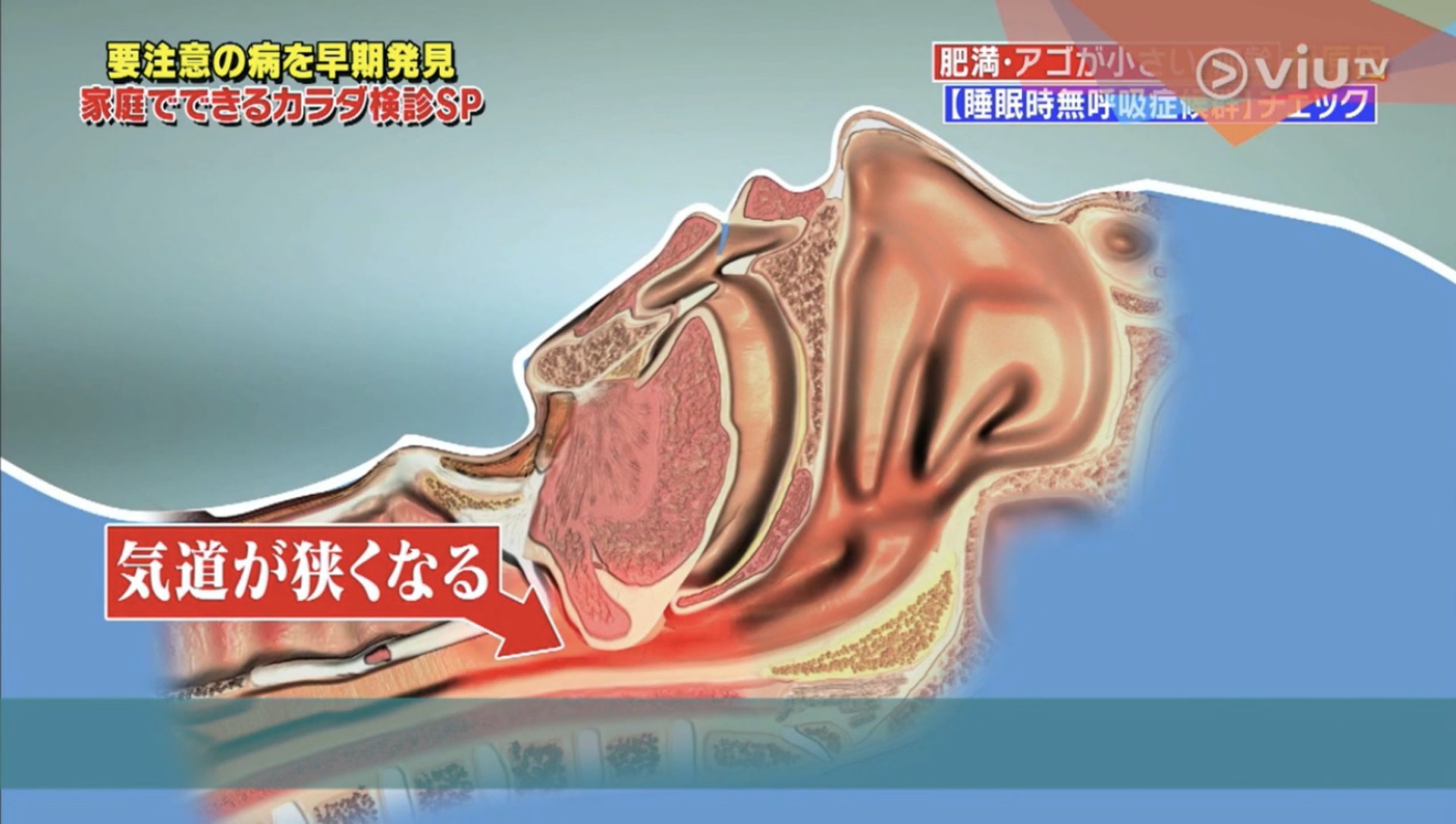 當睡覺時舌頭再下墜,就會更容易導致氣道變窄。(Viu TV《恐怖醫學》影片截圖) 當睡覺時舌頭再下墜,就會更容易導致氣道變窄。(Viu TV《恐怖醫學》影片截圖)