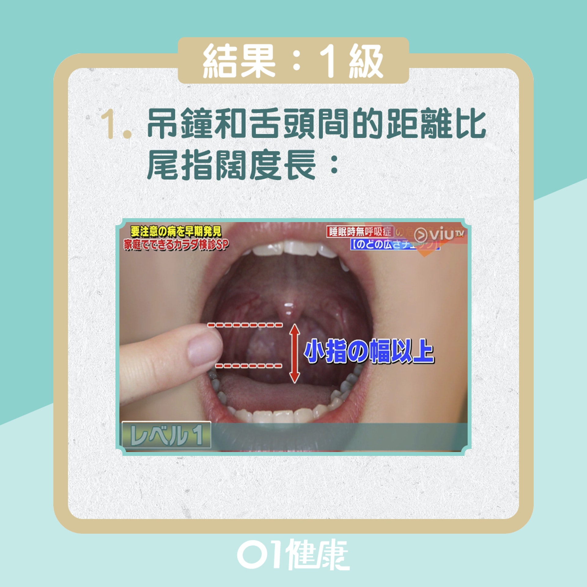 睡眠窒息患病夙險測試!(01製圖) 睡眠窒息患病夙險測試!(01製圖)