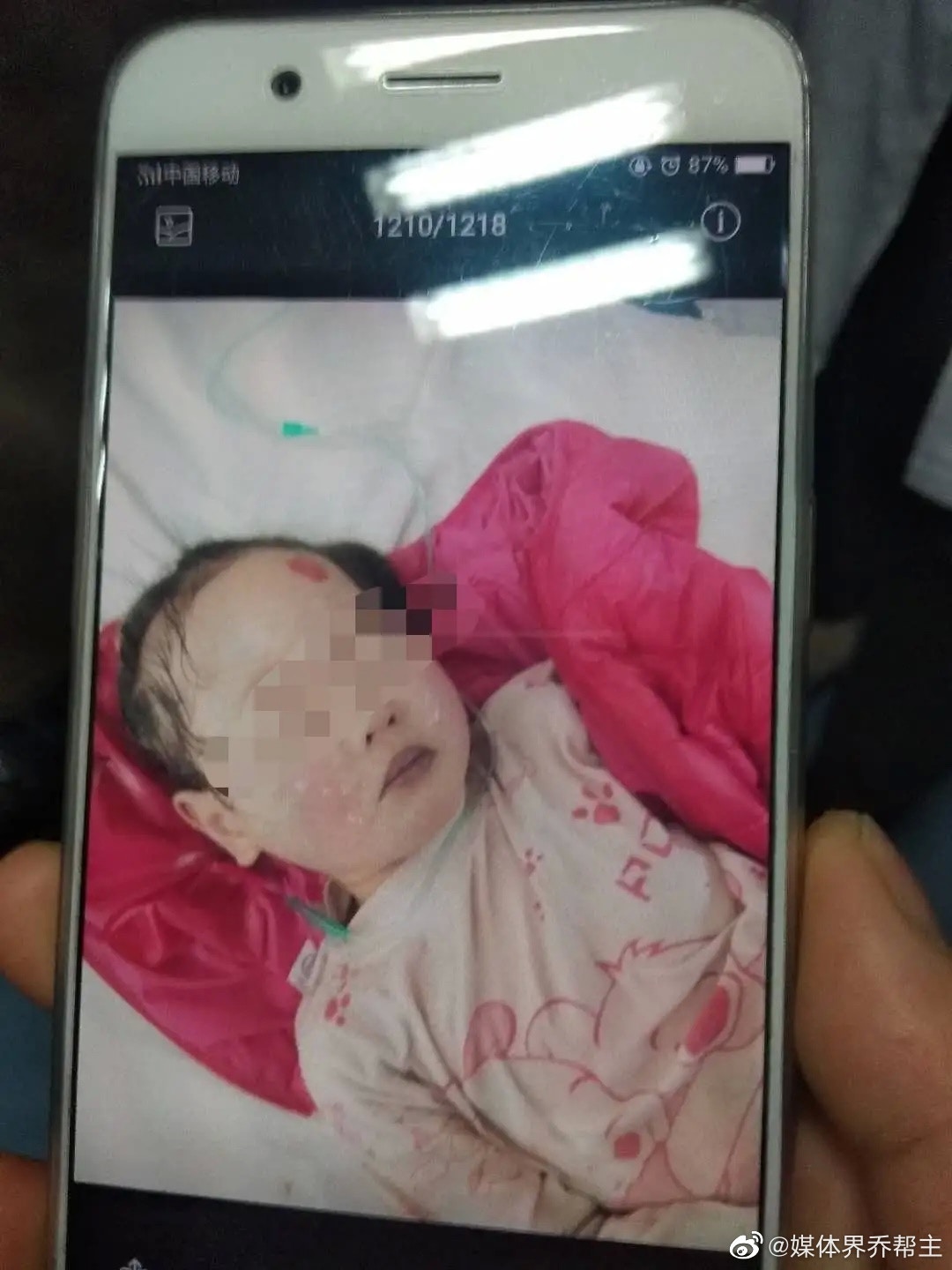 事件導致共計23名幼兒中毒。（微博）