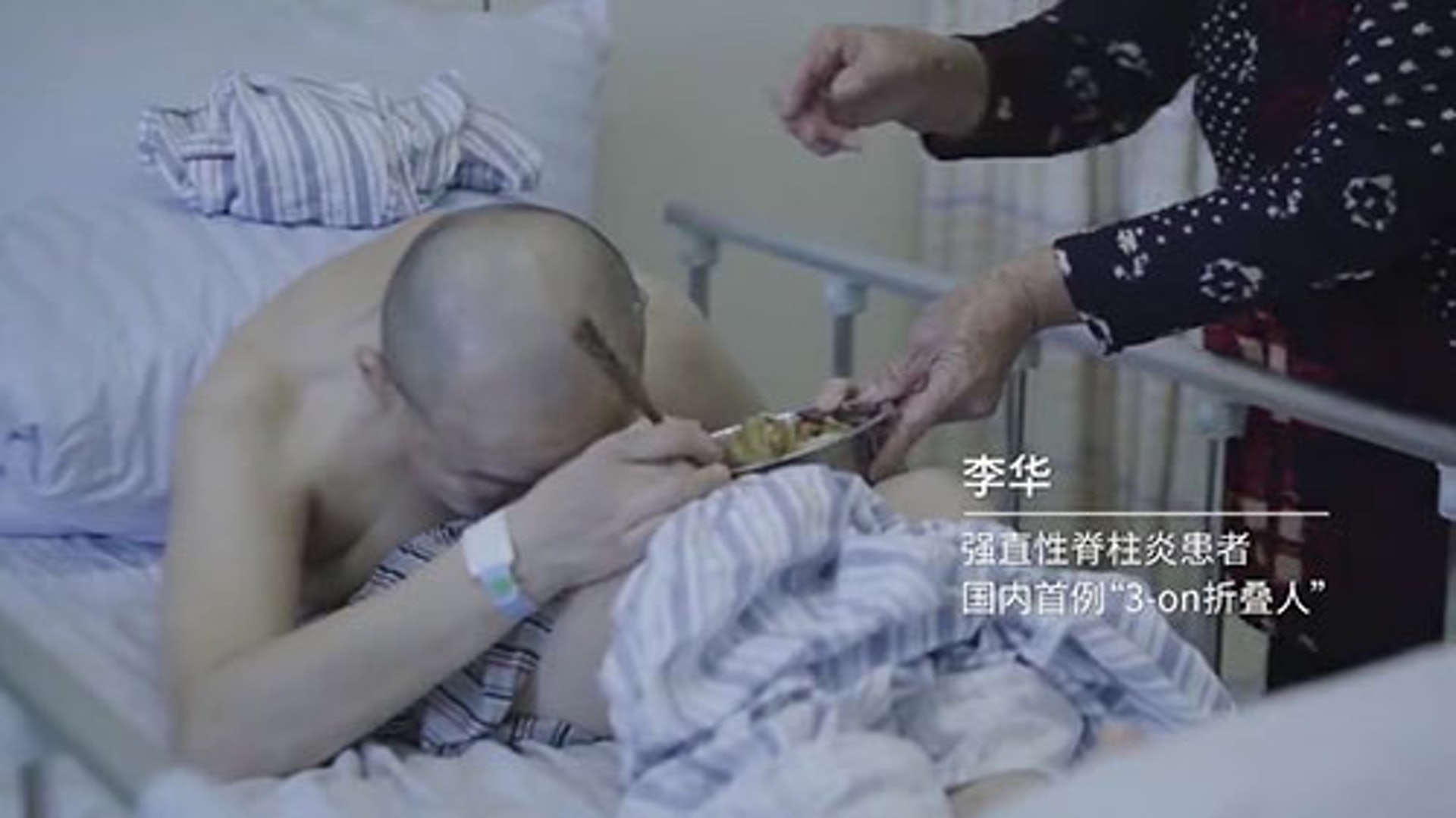 自從患病以來,李華的身體更呈現完全摺疊狀態,無法直立行走或平躺睡覺。((紀錄片截圖) 自從患病以來,李華的身體更呈現完全摺疊狀態,無法直立行走或平躺睡覺。((紀錄片截圖)