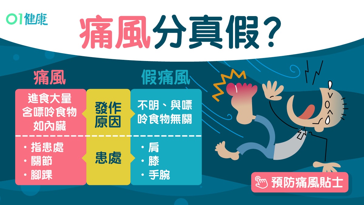 痛風|關節腫痛尿酸正常可能「假痛風」!7類高危人士戒口都冇用 痛風|關節腫痛尿酸正常可能「假痛風」!7類高危人士戒口都冇用