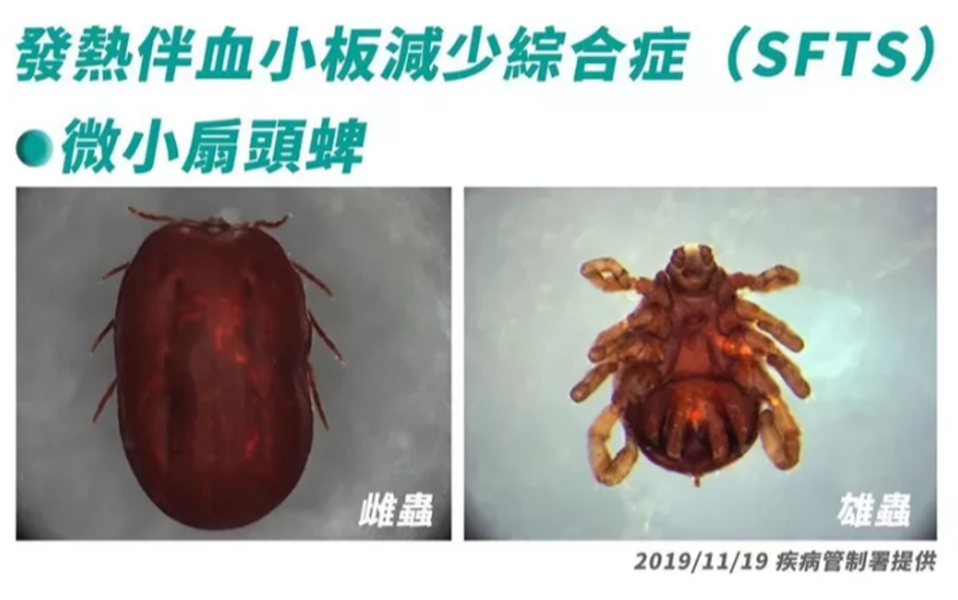 「新布尼亞病毒」是10年前被確認的急性傳染病,主要媒介是蜱蟲叮咬。(台灣疾管署) 「新布尼亞病毒」是10年前被確認的急性傳染病,主要媒介是蜱蟲叮咬。(台灣疾管署)