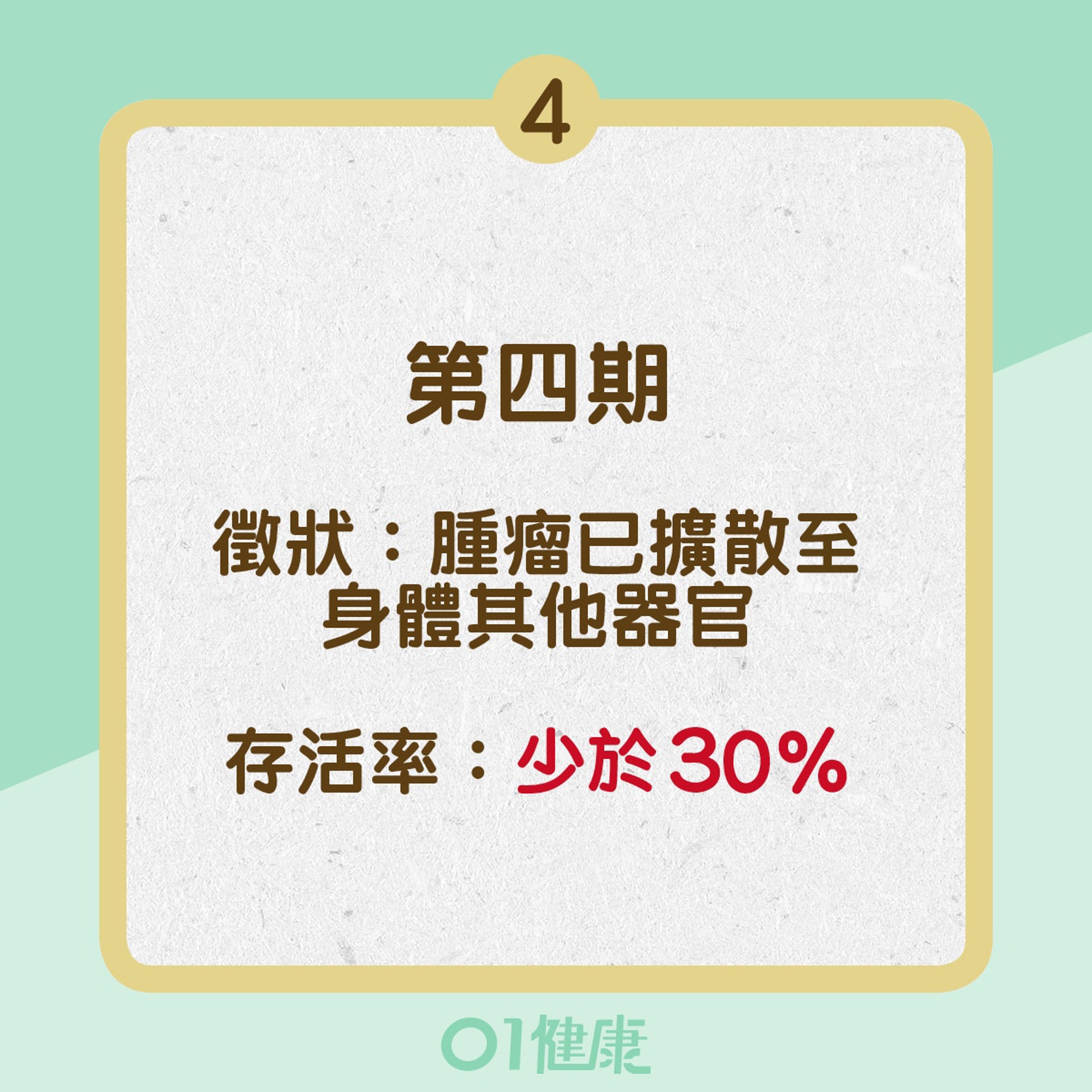 肺癌四個階段(01製圖) 肺癌四個階段(01製圖)