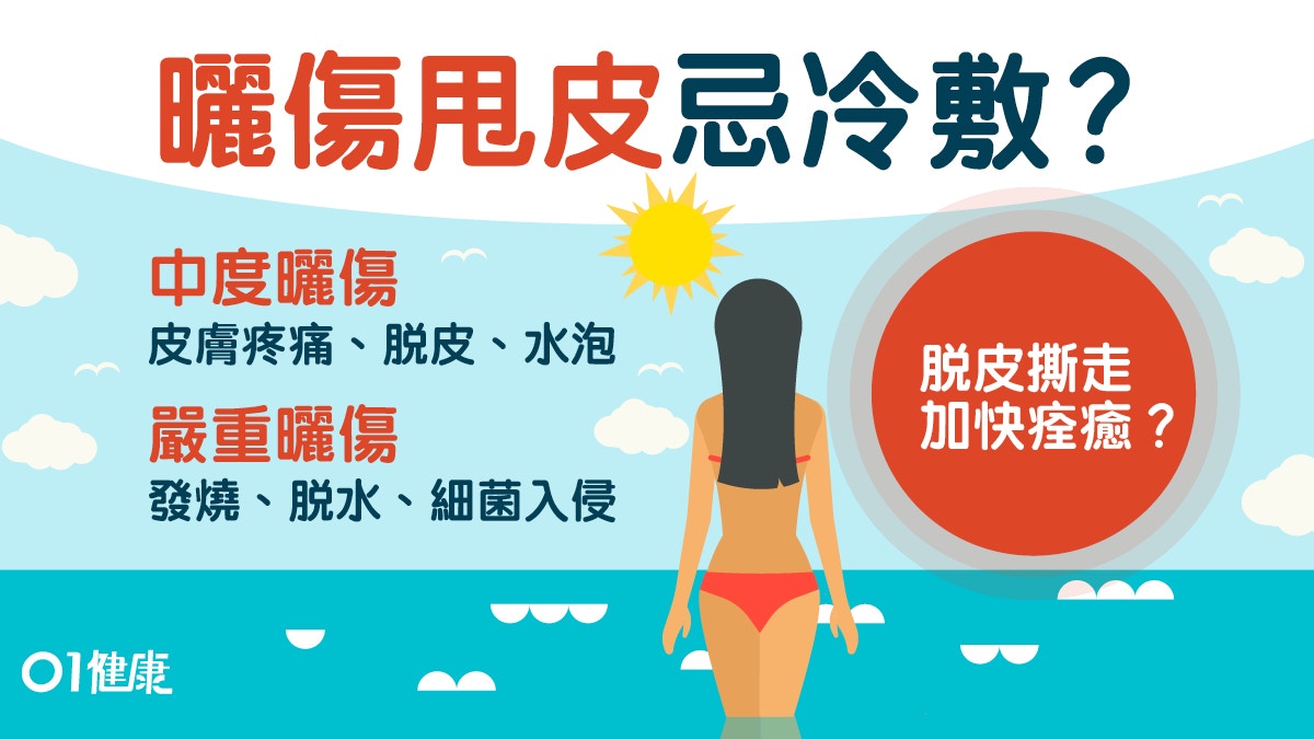 【防曬】曬傷甩皮好唔好撕？冰敷或熱敷？5大曬傷處理一直都做錯