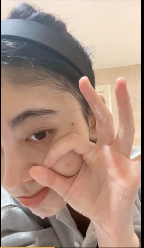 鞠婧禕皮膚狀態欠佳還長了一個痘痘。(鞠婧禕@微博) 鞠婧禕皮膚狀態欠佳還長了一個痘痘。(鞠婧禕@微博)